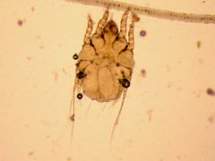 Sarcoptes scabiei by (c) laboratorio diagnostica ancona IZSUM, some rights reserved (CC BY). Used under a CC-BY license.