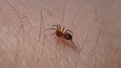 Oedothorax by (c) Julien Tchilinguirian, some rights reserved (CC BY), uploaded by Julien Tchilinguirian. Used under a CC-BY license.