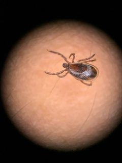 Ixodes scapularis by (c) Senna Bryce Robeson, some rights reserved (CC BY), uploaded by Senna Bryce Robeson. Used under a CC-BY license.