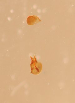 Actiastes foveicollis by no rights reserved, uploaded by Nick Bédard. Used under a CC0 license.