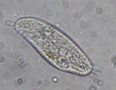 Hypotrichia by (c) Em Lamond, some rights reserved (CC BY), uploaded by Em Lamond. Used under a CC-BY license.