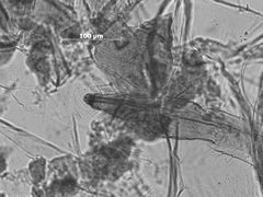 Acyrthosiphon bidenticola by the Smithsonian. Used under a CC0 license.