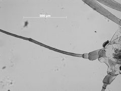 Acyrthosiphon bidenticola by the Smithsonian. Used under a CC0 license.