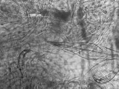 Capitophorus shepherdiae by the Smithsonian. Used under a CC0 license.