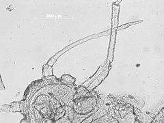 Cavariella pustula by the Smithsonian. Used under a CC0 license.