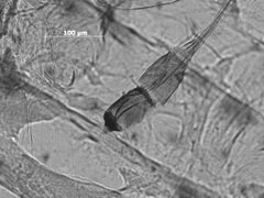 Essigella agilis by the Smithsonian. Used under a CC0 license.