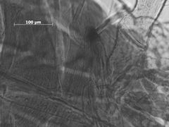 Euceraphis gillettei by the Smithsonian. Used under a CC0 license.