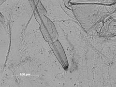 Hyalomyzus pocosinus by the Smithsonian. Used under a CC0 license.
