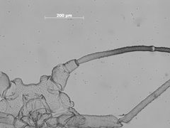 Hyalomyzus pocosinus by the Smithsonian. Used under a CC0 license.