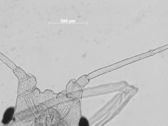 Hyalopterus dactylidis by the Smithsonian. Used under a CC0 license.