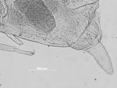 Hyalopterus dactylidis by the Smithsonian. Used under a CC0 license.
