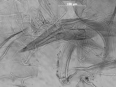 Macrosiphoniella frigidicola by the Smithsonian. Used under a CC0 license.