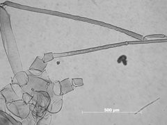Macrosiphoniella frigidicola by the Smithsonian. Used under a CC0 license.