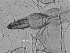 Macrosiphum badium by the Smithsonian. Used under a CC0 license.