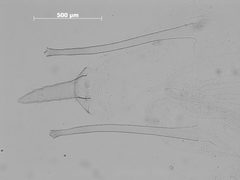 Macrosiphum willamettense by the Smithsonian. Used under a CC0 license.