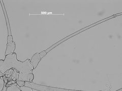 Macrosiphum willamettense by the Smithsonian. Used under a CC0 license.