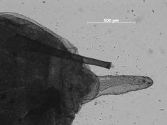Macrosiphum zionense by the Smithsonian. Used under a CC0 license.