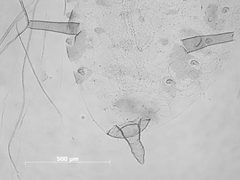 Nasonovia (Kakimia) hottesi by the Smithsonian. Used under a CC0 license.