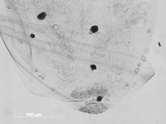 Pemphigus knowltoni by the Smithsonian. Used under a CC0 license.