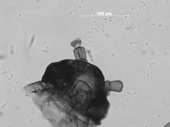 Pemphigus populiglobuli by the Smithsonian. Used under a CC0 license.