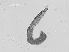 Pemphigus populiglobuli by the Smithsonian. Used under a CC0 license.