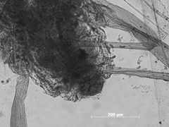 Pemphigus populitransversus by the Smithsonian. Used under a CC0 license.