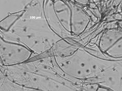 Pleotrichophorus antennarius by the Smithsonian. Used under a CC0 license.