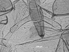 Rhopalosiphoninus kelleri by the Smithsonian. Used under a CC0 license.