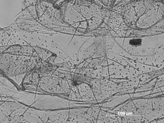 Tamalia inquilinus by the Smithsonian. Used under a CC0 license.