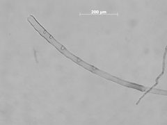 Tuberculatus kiowanicus by the Smithsonian. Used under a CC0 license.
