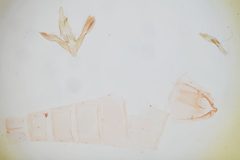 Glyphidocera septentrionella by the Smithsonian. Used under a CC0 license.