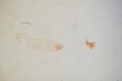 Stilbosis lonchocarpella by the Smithsonian. Used under a CC0 license.