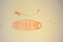 Agonopterix chrautis by the Smithsonian. Used under a CC0 license.