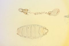 Depressaria betulella by the Smithsonian. Used under a CC0 license.