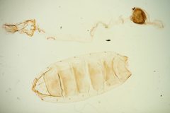 Ethmia semitenebrella by the Smithsonian. Used under a CC0 license.
