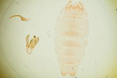 Anacampsis psoraliella by the Smithsonian. Used under a CC0 license.