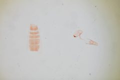 Besciva longitudinella by the Smithsonian. Used under a CC0 license.