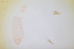 Trypanisma fagella by the Smithsonian. Used under a CC0 license.