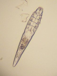 Demodex Milbe adult by Kalumet. Used under a CC BY-SA 3.0 license.