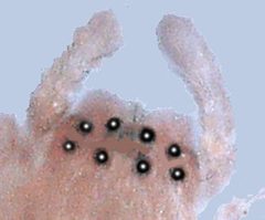 Chiracanthium eye pattern by Patrick Edwin Moran. Used under a CC BY-SA 3.0 license.