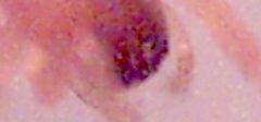 Florinda coccinoa eyes by wikipedia. Used under a CC BY 2.0 license.