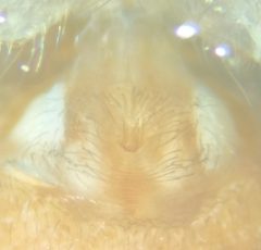 Oecobius maculatus epigyne grossie 80x by Skithéo. Used under a CC BY-SA 4.0 license.