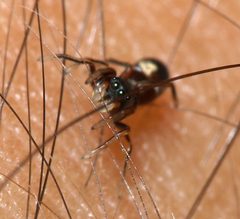 Synageles venator female by portioid. Used under a CC BY-SA 4.0 license.