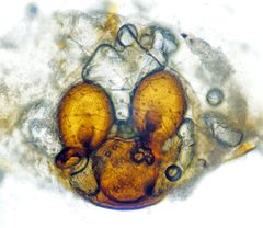 Theridion varians - 33985838578 by AJC1. Used under a CC BY-SA 2.0 license.