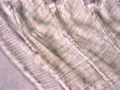 Penilia avirostris 146626979 by Lukas Schärer. Used under a CC BY 4.0 license.
