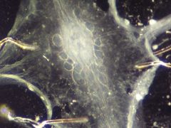 Stomatogastric ganglion by Wstein. Used under a CC BY 3.0 license.