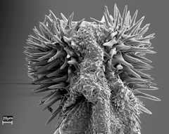 Callosobruchus maculatus penis by Johanna Rönn, Department of Animal Ecology, Uppsala University.. Used under a CC BY-SA 1.0 license.