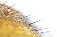 Malachius aeneus hairs by Siga. Used under a CC BY-SA 3.0 license.