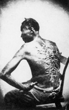 Slavetreatment by wikipedia. Used under a Public domain license.