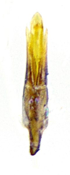 Cercyon lateralis Aedoeagus by Siga. Used under a CC BY-SA 3.0 license.